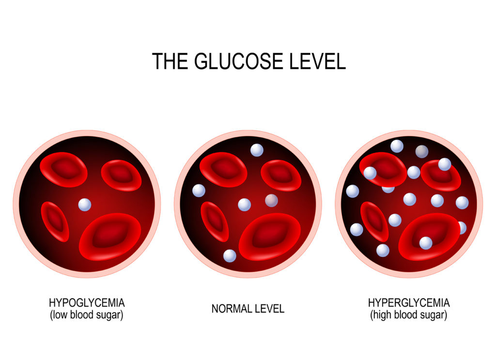 Different sugar levels explained, normal, hypoglycaemia, hyperglycaemia